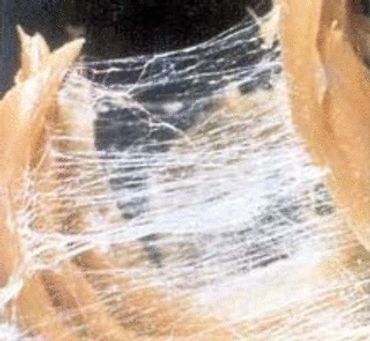 Fascia Fascia